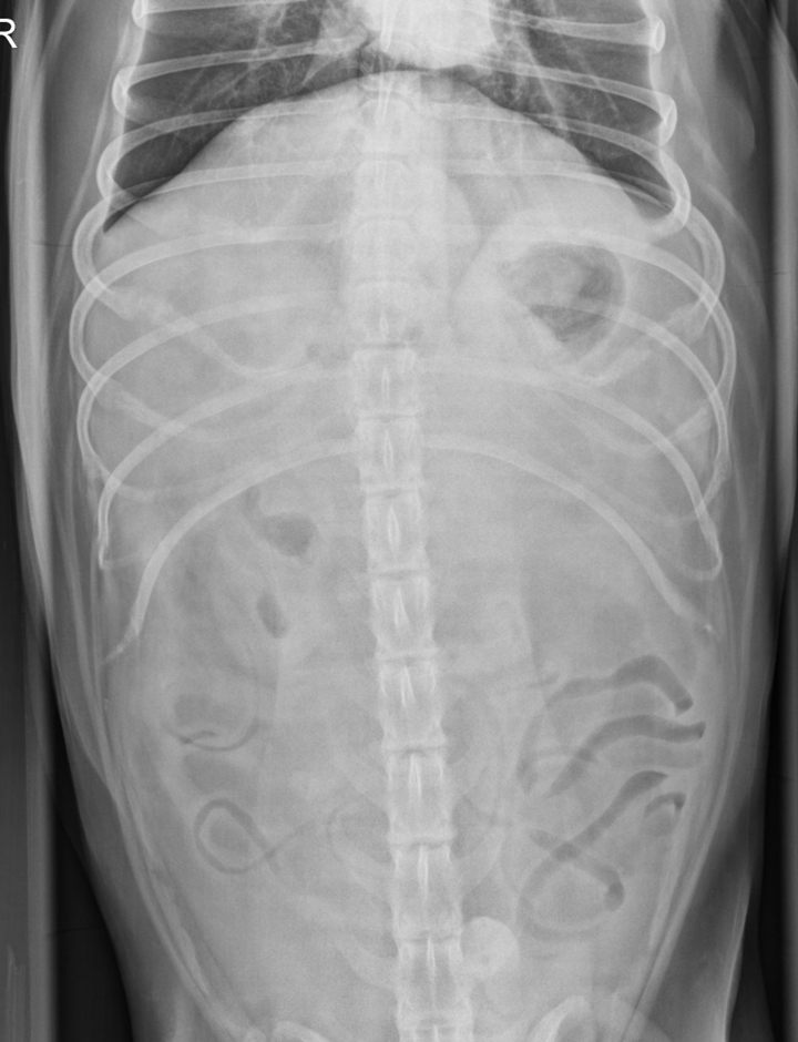 worka/vanillajswheelzoom